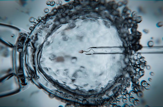 IVF-Prozess unter dem Mikroskop
