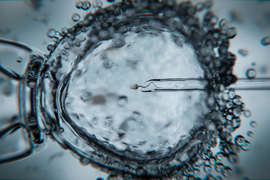 Fécondation in vitro avec injection intracytoplasmique de spermatozoïdes